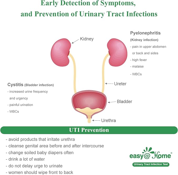Easy@Home Urinary Tract Infection Test Strips 25 Pack, Individual Pouch UTI Urine Testing Kit for Urinalysis and Detection of Leukocytes and Nitrites (UTIPOUCH-25P)