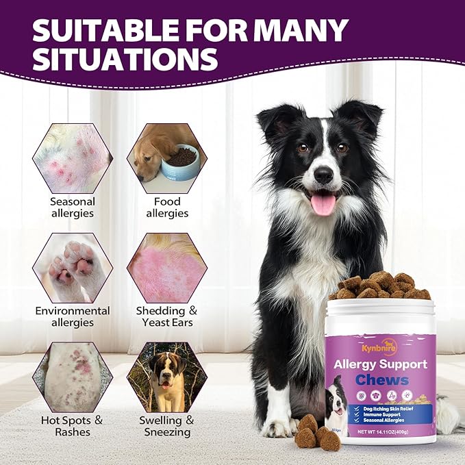 Dog Allergy Chews for Itchy Skin and Seasonal Allergies, Dog Allergy and Itching Skin Relief with Probiotics and Turmeric, Allergy Paw Relief and Dogs Coat Immune -160ct